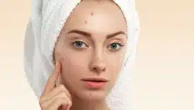 Sivilceler İçin Salisilik Asit